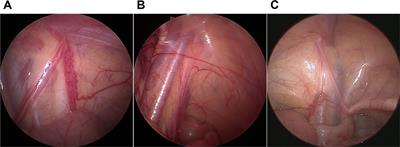 Testicular regression syndrome: A retrospective analysis of clinical and histopathological features in 570 cases